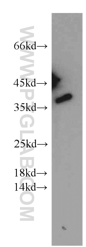 Western Blot (WB) analysis of A375 cells using MAGEA4 Polyclonal antibody (55109-1-AP)
