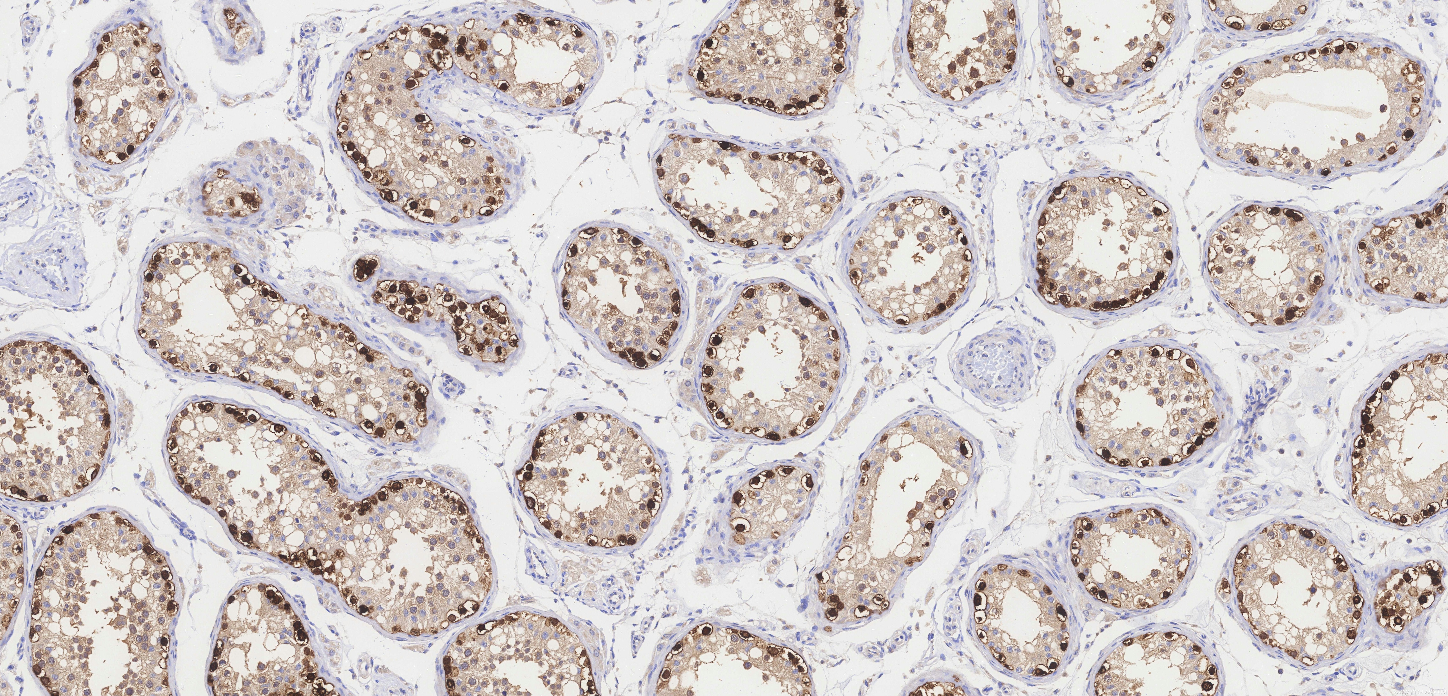 Immunohistochemistry (IHC) staining of human testis tissue using MAGEA4 Recombinant monoclonal antibody (84248-4-RR)