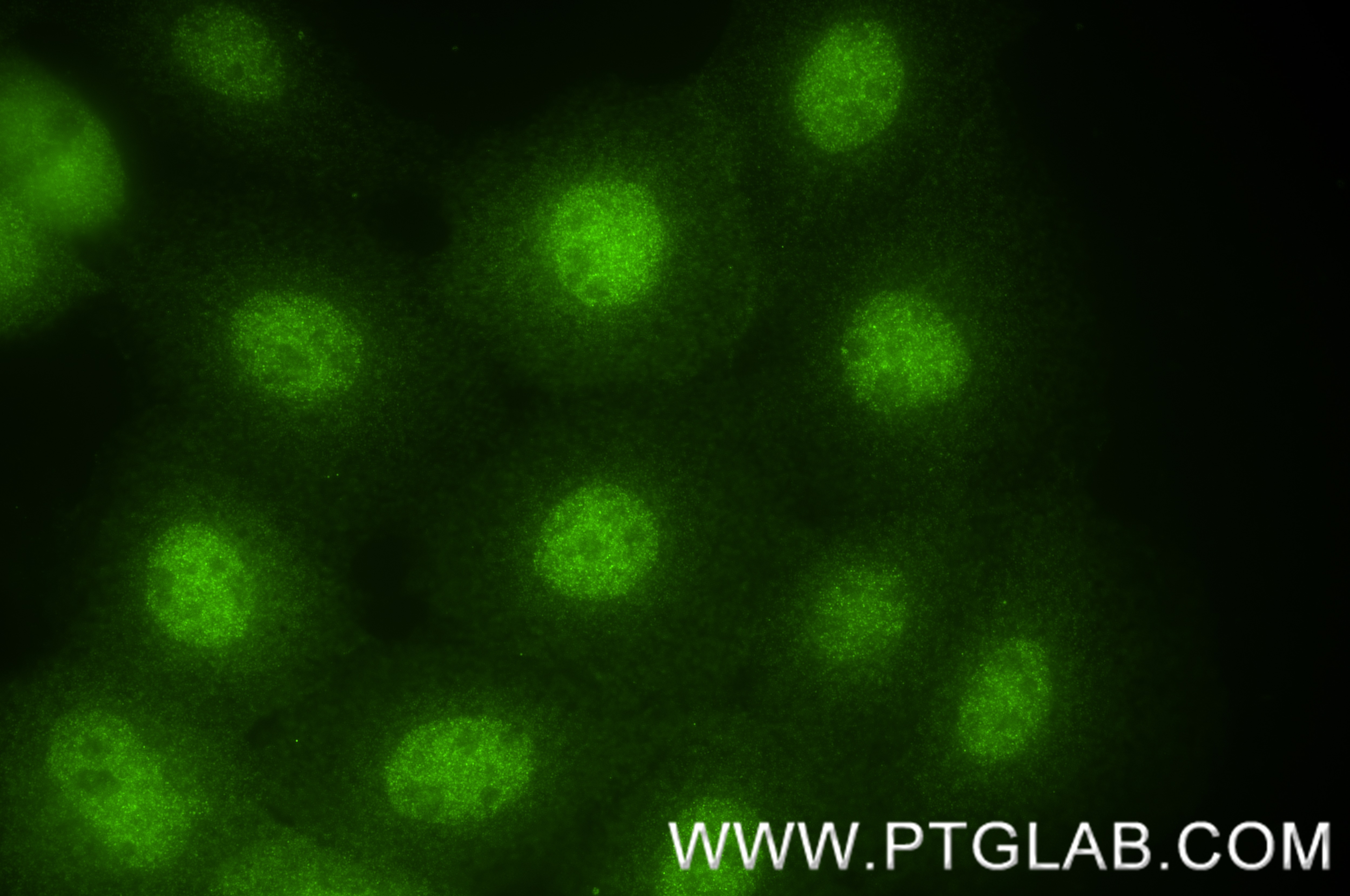 Immunofluorescence (IF) / fluorescent staining of A431 cells using MAGEA4 Recombinant antibody (84248-6-RR)