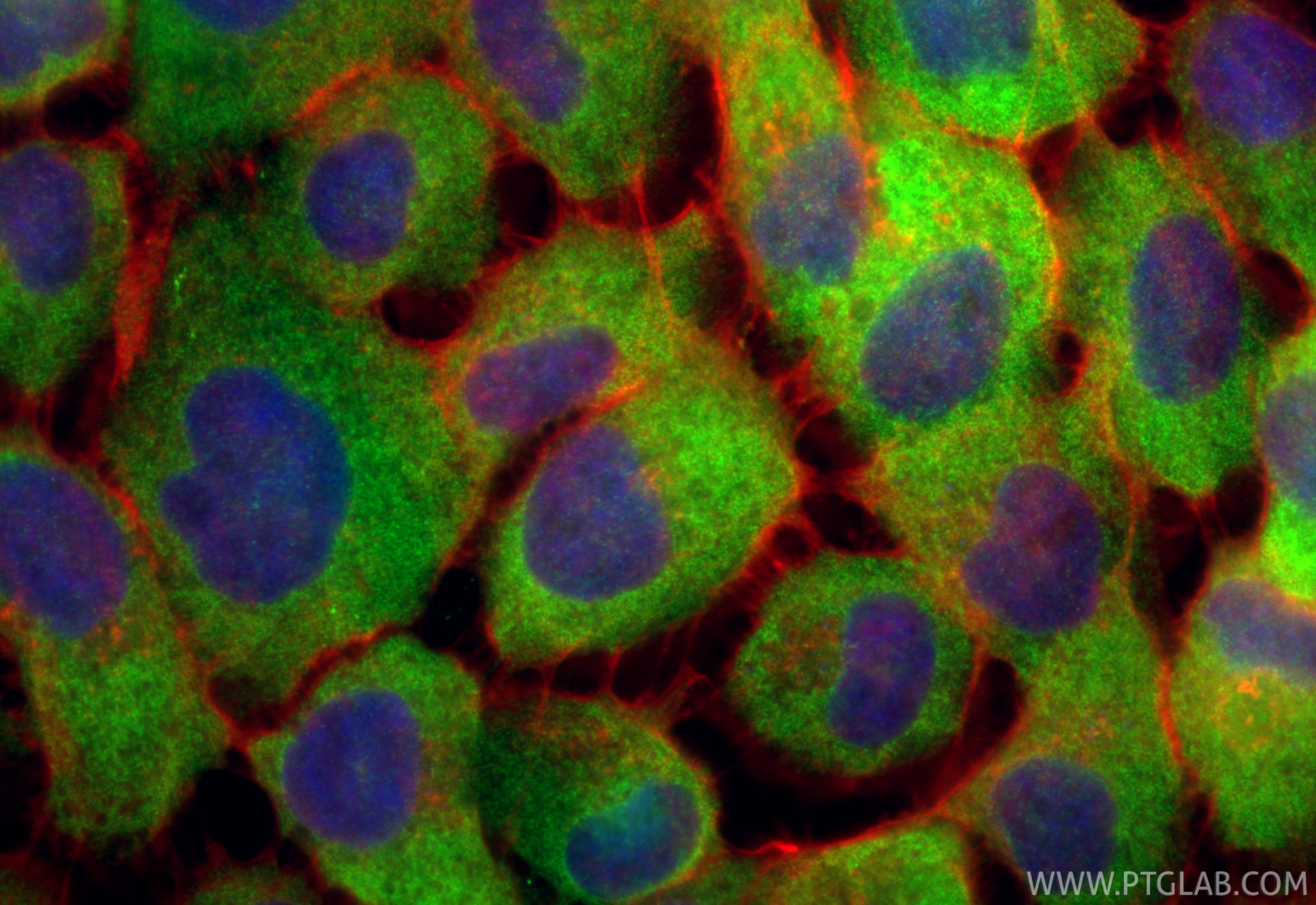 Immunofluorescence (IF) / fluorescent staining of A431 cells using MAGEA4 Recombinant antibody (84248-6-RR)