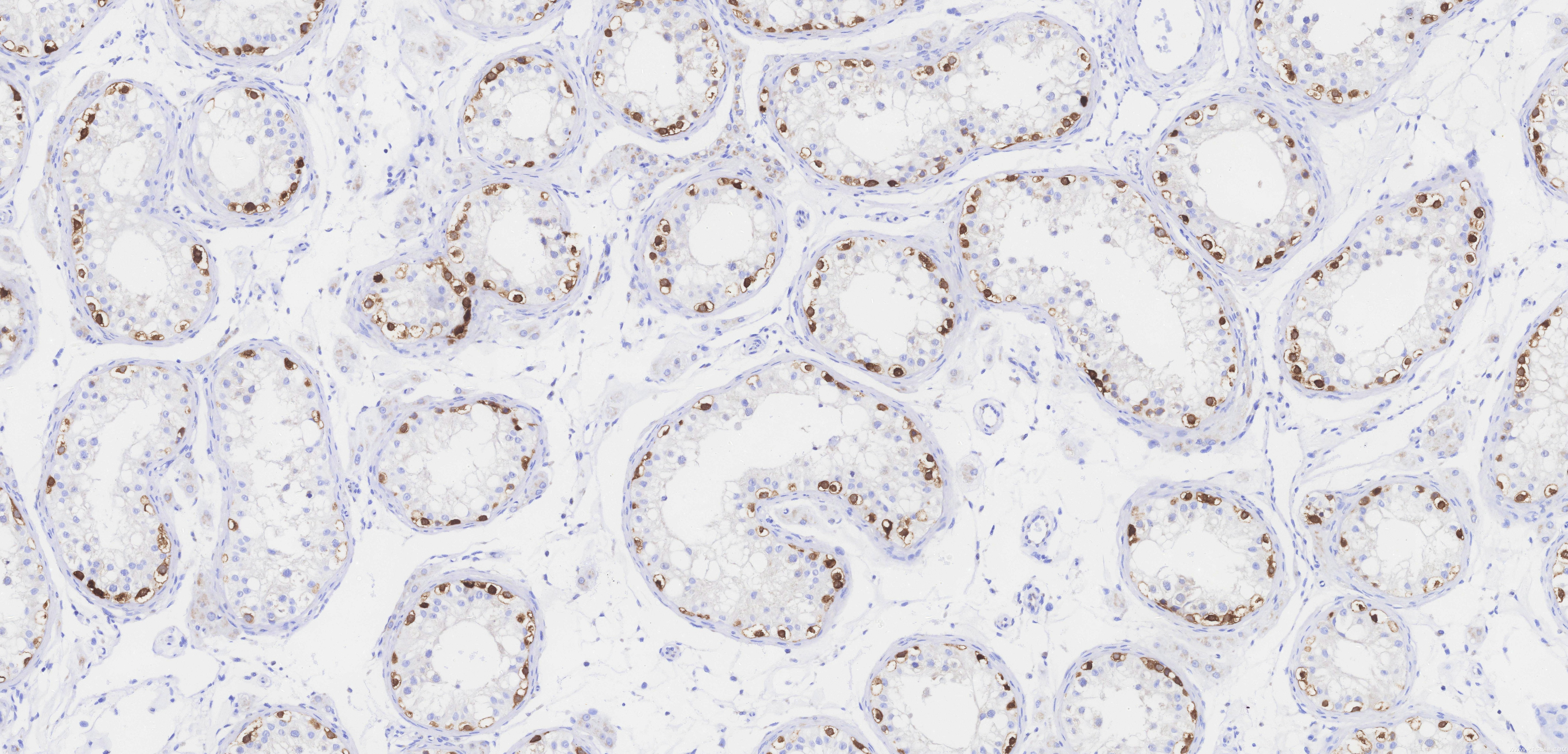 Immunohistochemistry (IHC) staining of human testis tissue using MAGEA4 Recombinant monoclonal antibody (84248-8-RR)