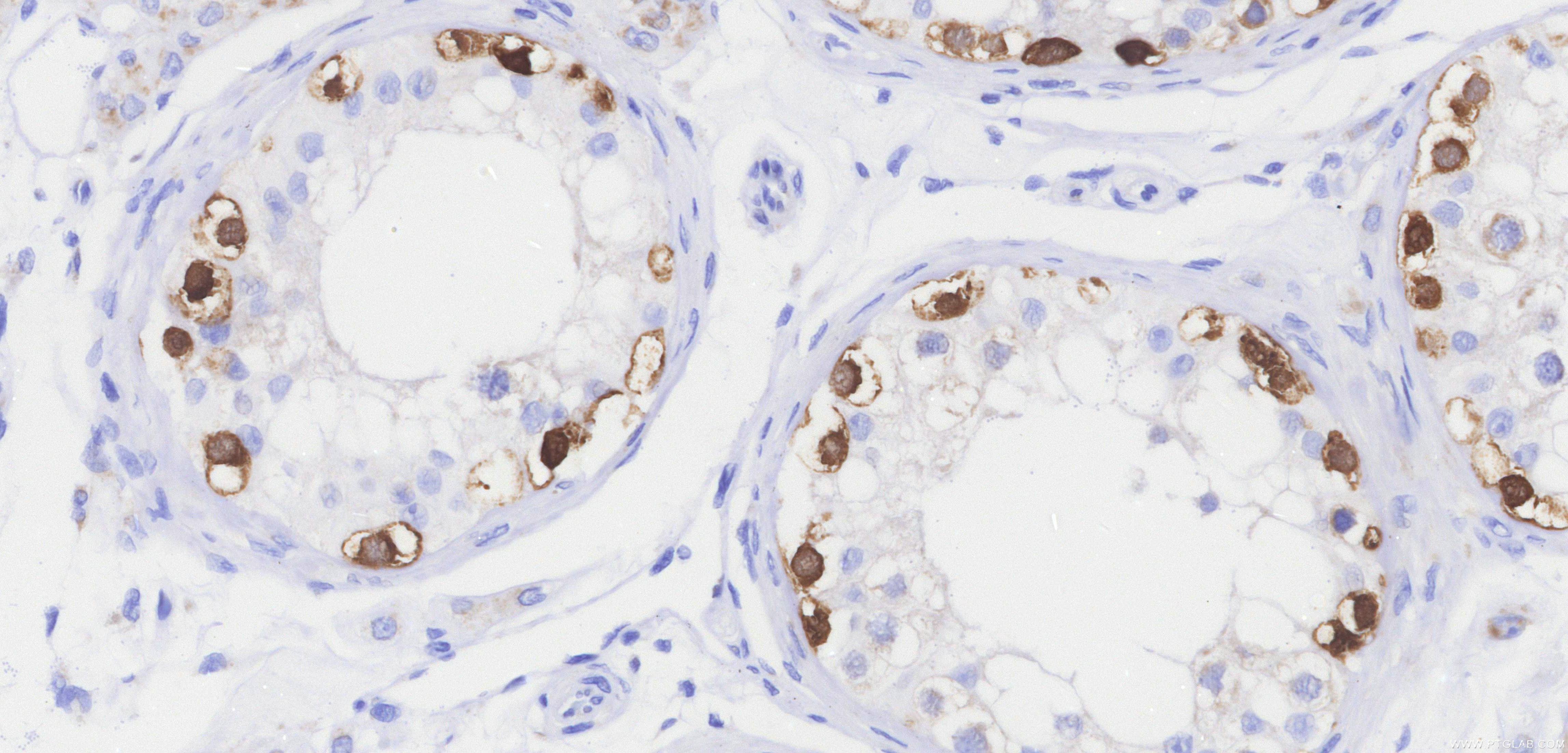 Immunohistochemistry (IHC) staining of human testis tissue using MAGEA4 Recombinant monoclonal antibody (84248-8-RR)