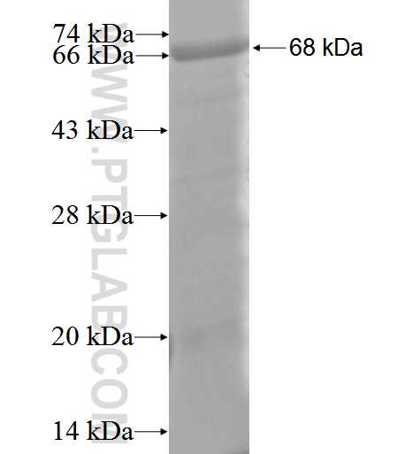 MAGEA4 fusion protein Ag3193 SDS-PAGE