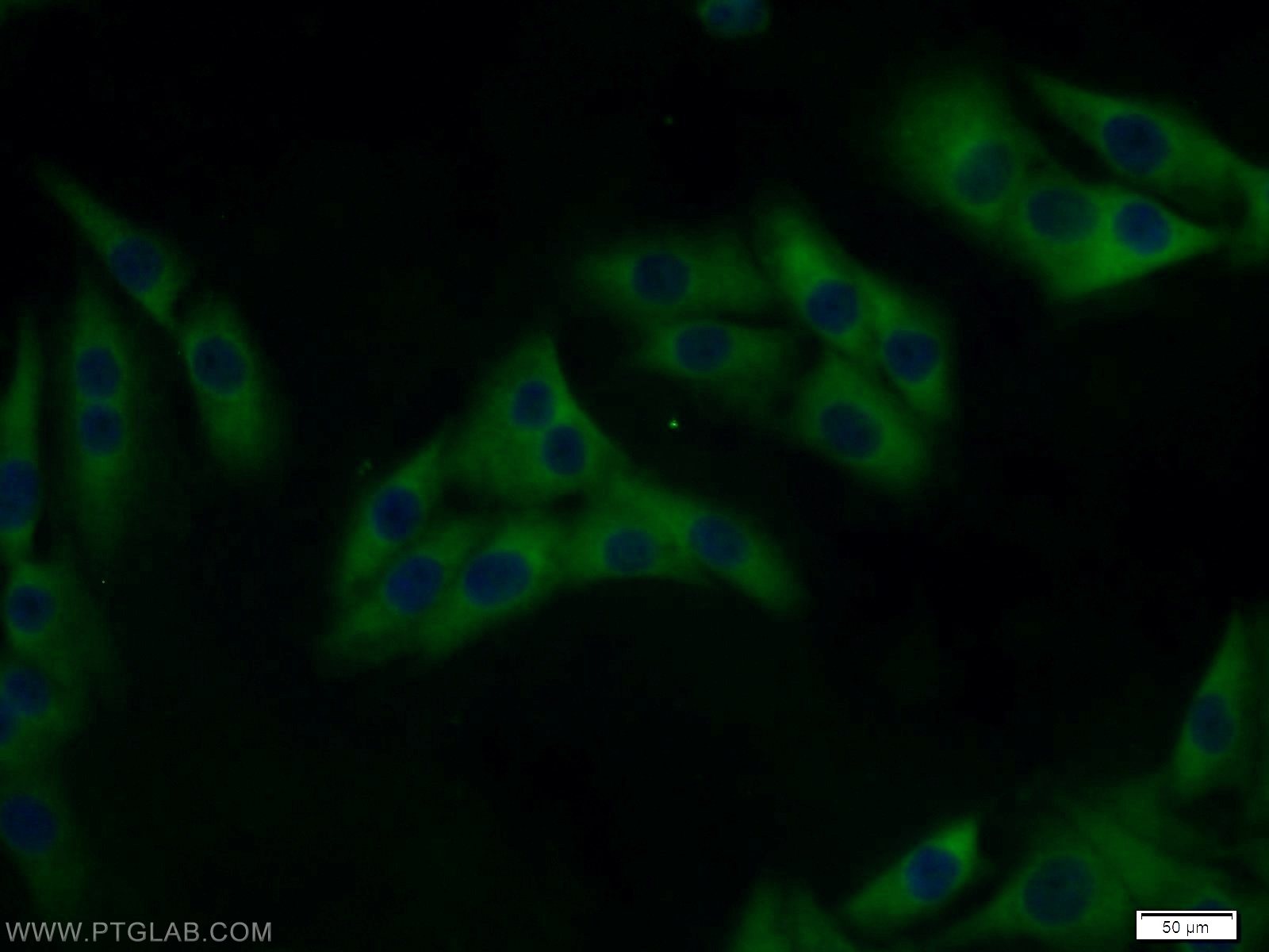 Immunofluorescence (IF) / fluorescent staining of A375 cells using MAGEA6 Polyclonal antibody (14602-1-AP)