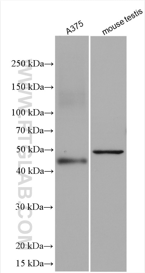 Western Blot (WB) analysis of various lysates using MAGEA6 Polyclonal antibody (14602-1-AP)