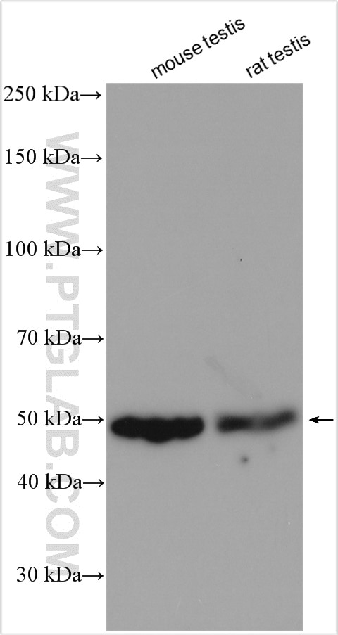 Western Blot (WB) analysis of various lysates using MAGEA6 Polyclonal antibody (14602-1-AP)
