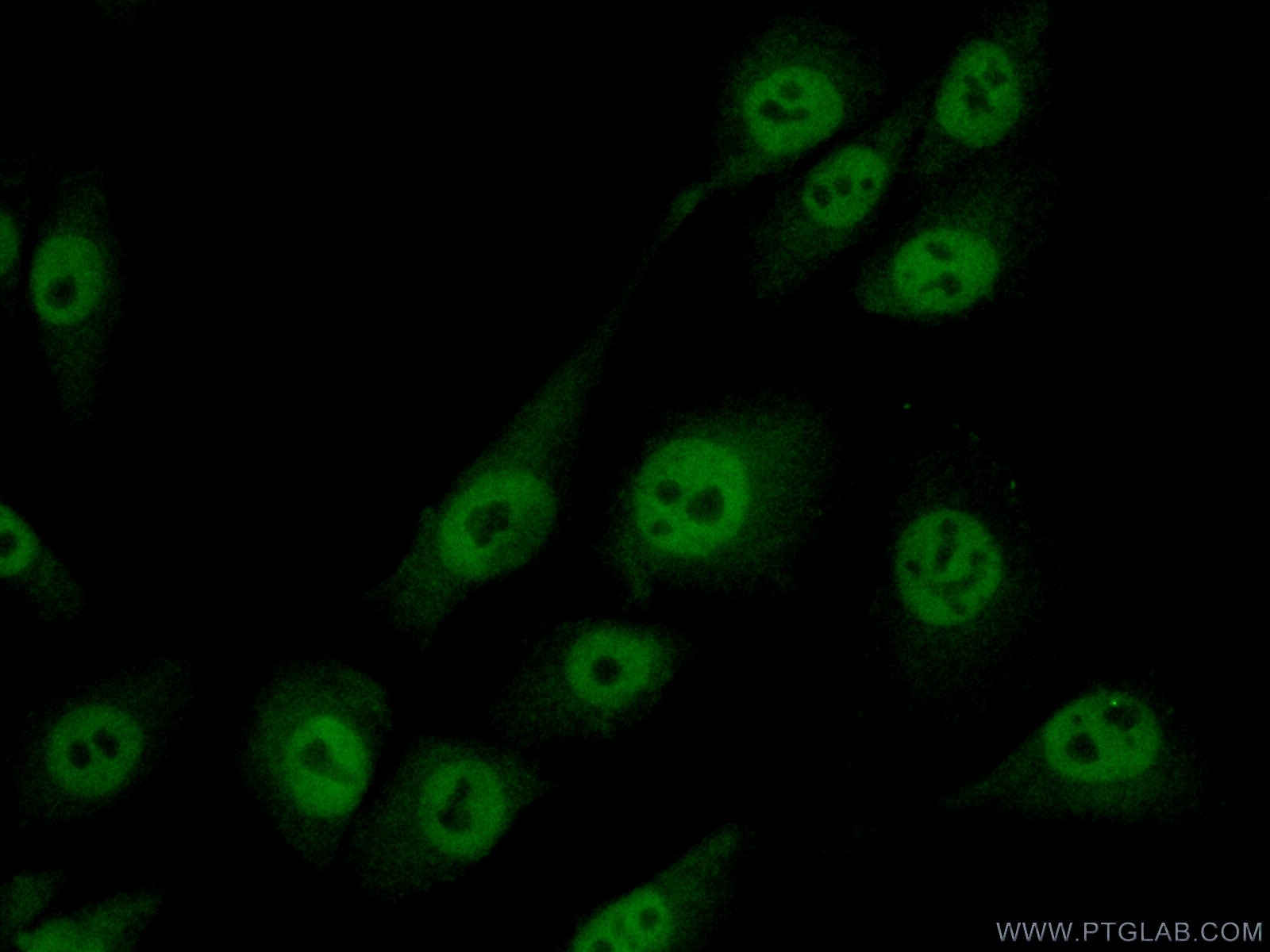 Immunofluorescence (IF) / fluorescent staining of A375 cells using MAGEA8 Polyclonal antibody (15045-1-AP)