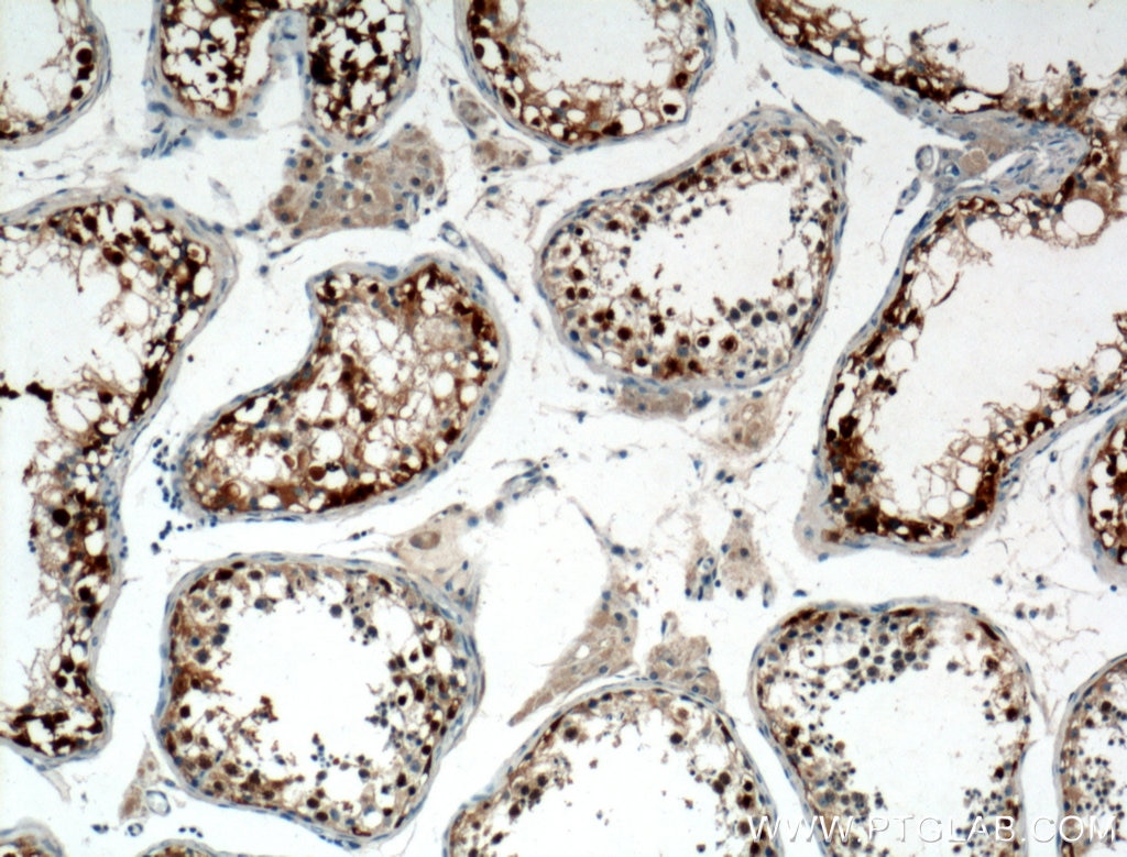Immunohistochemistry (IHC) staining of human testis tissue using MAGEA8 Polyclonal antibody (15045-1-AP)