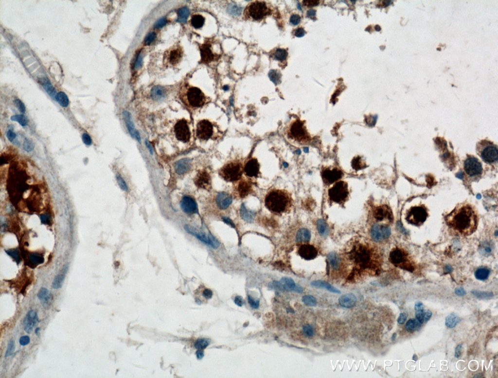 Immunohistochemistry (IHC) staining of human testis tissue using MAGEA8 Polyclonal antibody (15045-1-AP)