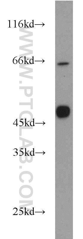 Western Blot (WB) analysis of A375 cells using MAGEA8 Polyclonal antibody (15045-1-AP)