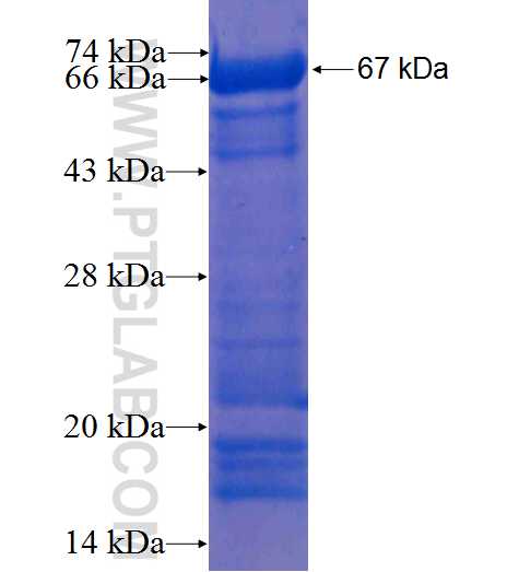 MAGEA8 fusion protein Ag6984 SDS-PAGE
