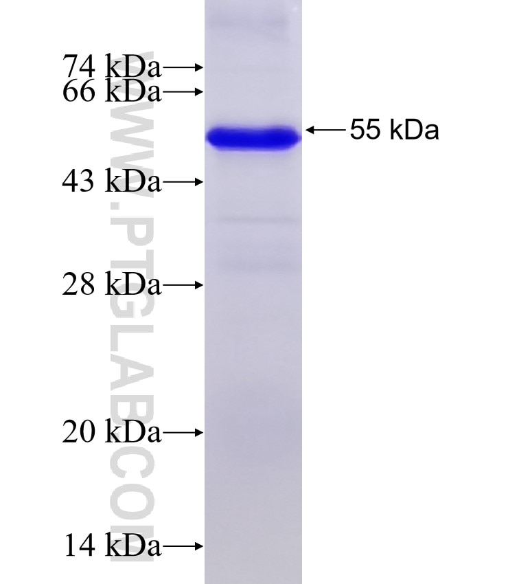 MAGEA9 fusion protein Ag7754 SDS-PAGE