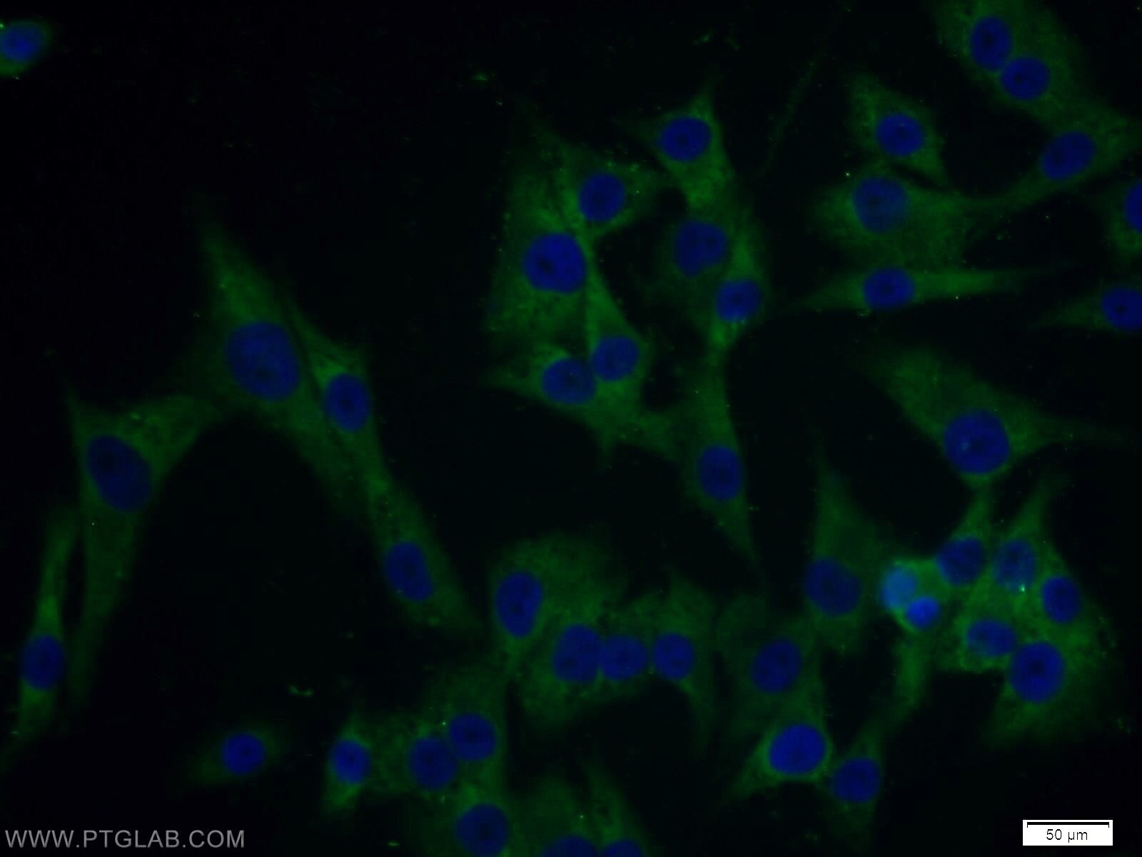 Immunofluorescence (IF) / fluorescent staining of A375 cells using MAGEB1 Polyclonal antibody (12400-1-AP)