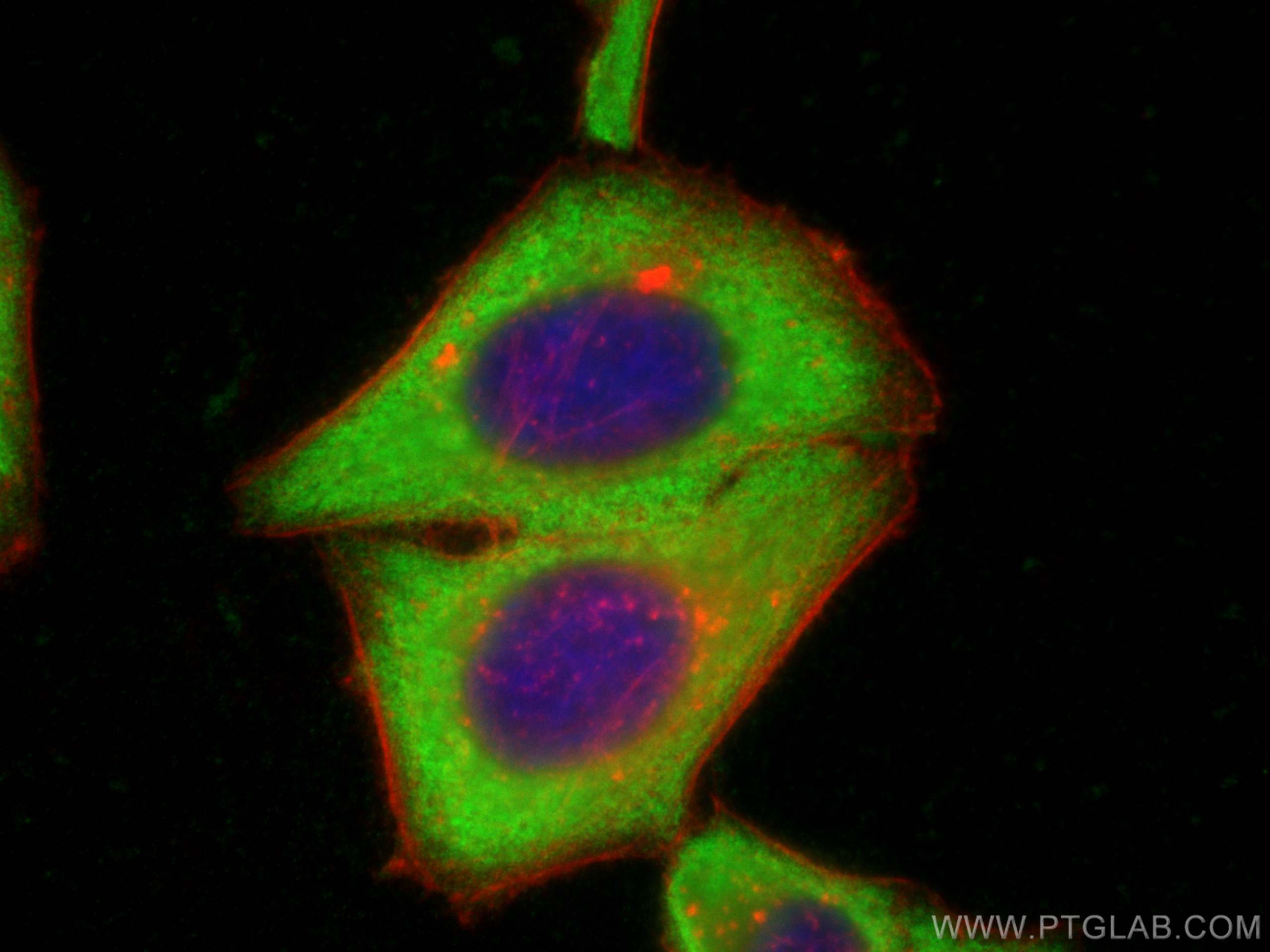 Immunofluorescence (IF) / fluorescent staining of HepG2 cells using MAGEB1 Polyclonal antibody (12400-1-AP)