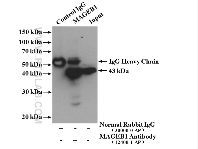 Immunoprecipitation (IP) experiment of HepG2 cells using MAGEB1 Polyclonal antibody (12400-1-AP)