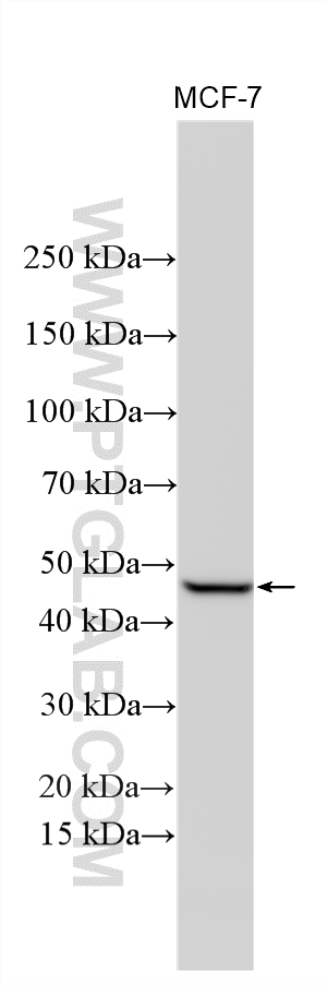 WB analysis of MCF-7 using 12400-1-AP Western Blot (WB) analysis of MCF-7 cells using MAGEB1 Polyclonal antibody (12400-1-AP)