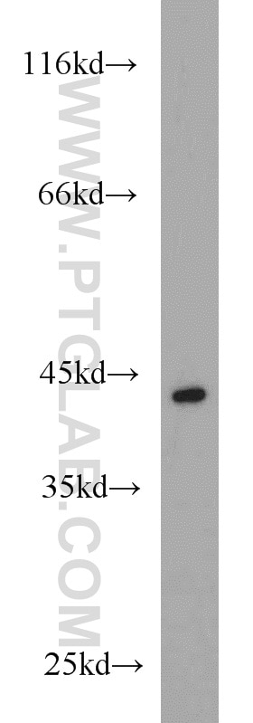 Western Blot (WB) analysis of A375 cells using MAGEB1 Polyclonal antibody (12400-1-AP)