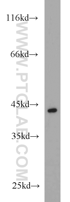 WB analysis of A375 using 12400-1-AP