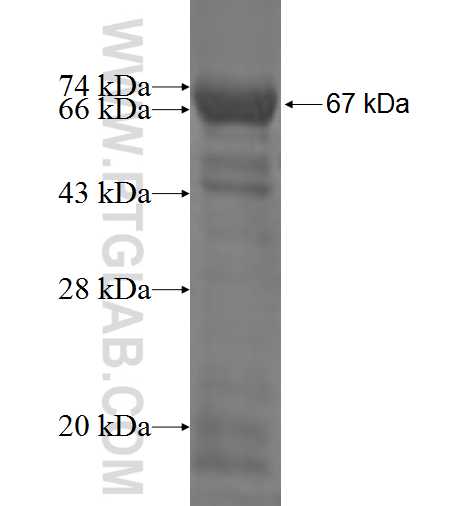 MAGEB1 fusion protein Ag3094 SDS-PAGE
