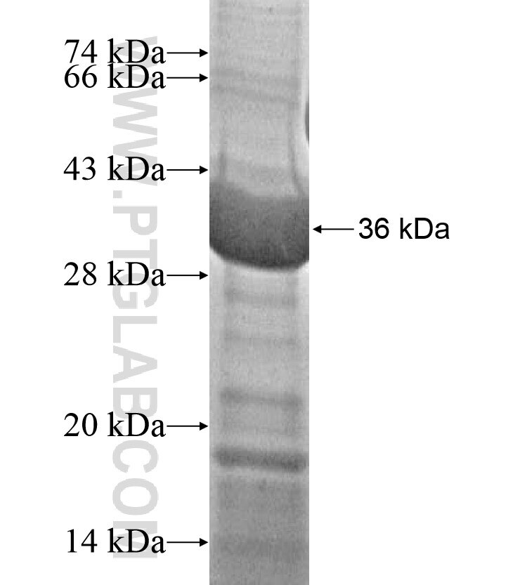 MAGEB10 fusion protein Ag17032 SDS-PAGE