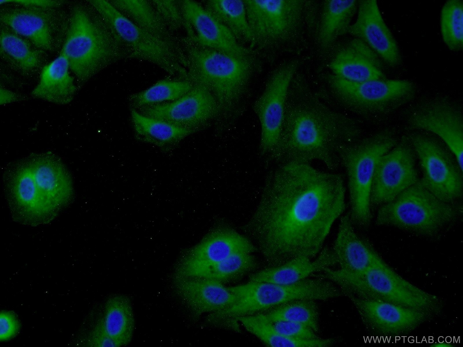 Immunofluorescence (IF) / fluorescent staining of A549 cells using MAGEB18 Polyclonal antibody (17494-1-AP)