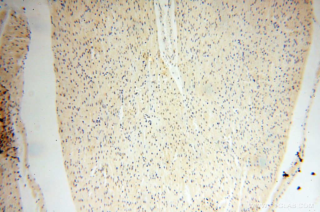 Immunohistochemistry (IHC) staining of human heart tissue using MAGEB18 Polyclonal antibody (17494-1-AP)