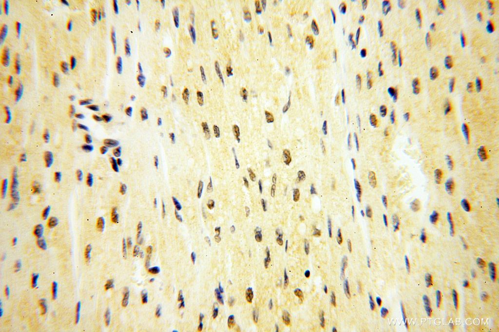 Immunohistochemistry (IHC) staining of human heart tissue using MAGEB18 Polyclonal antibody (17494-1-AP)