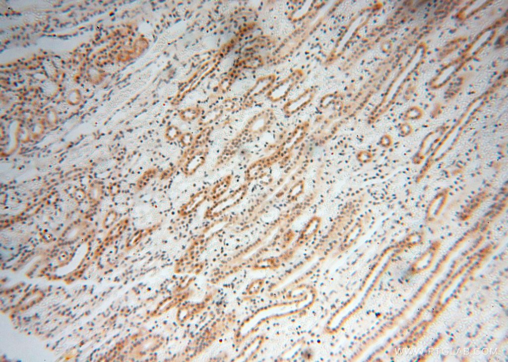 Immunohistochemistry (IHC) staining of human kidney tissue using MAGEB18 Polyclonal antibody (17494-1-AP)
