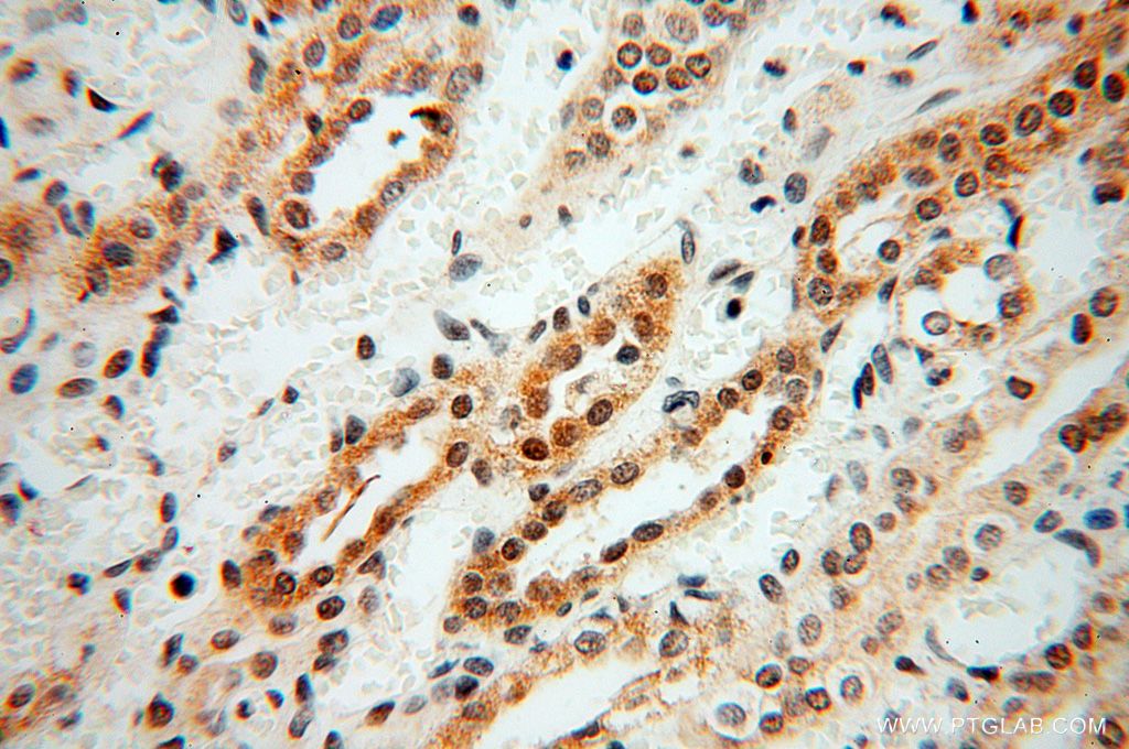 Immunohistochemistry (IHC) staining of human kidney tissue using MAGEB18 Polyclonal antibody (17494-1-AP)