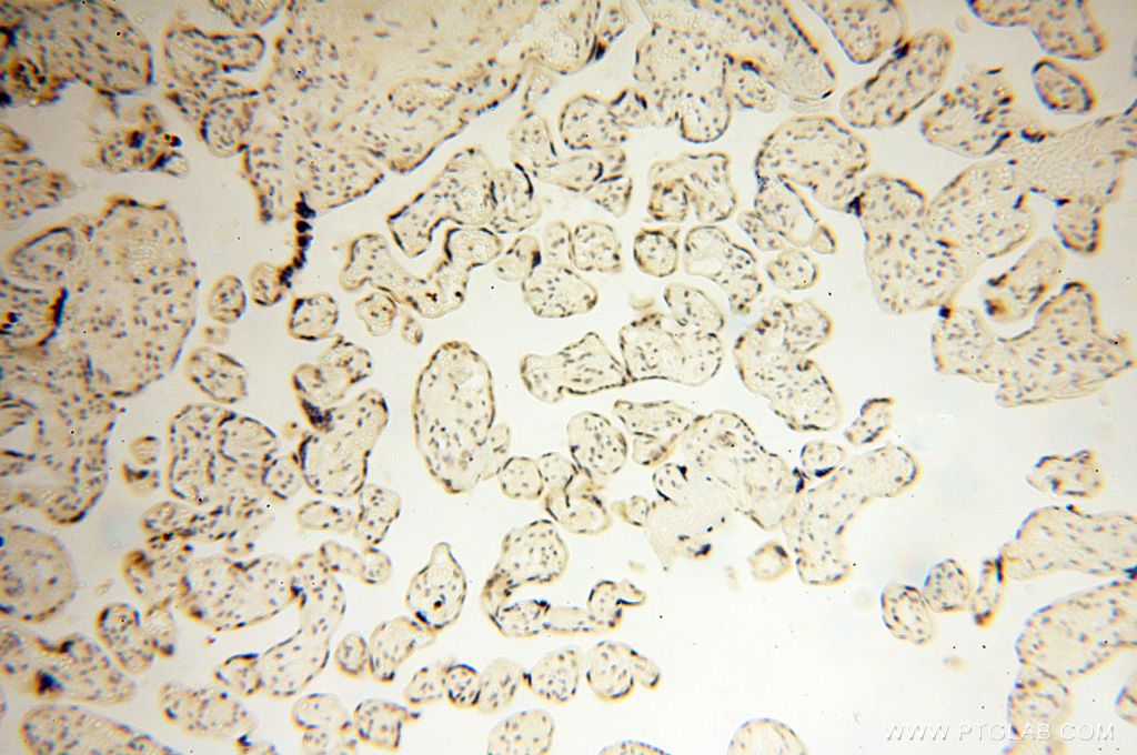 Immunohistochemistry (IHC) staining of human placenta tissue using MAGEB18 Polyclonal antibody (17494-1-AP)