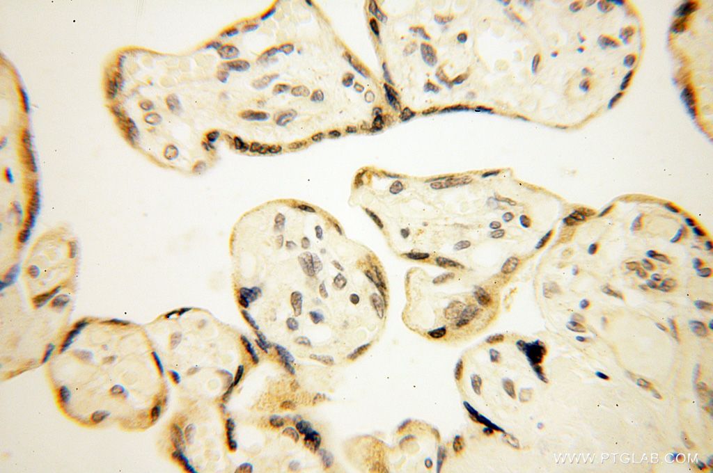 Immunohistochemistry (IHC) staining of human placenta tissue using MAGEB18 Polyclonal antibody (17494-1-AP)