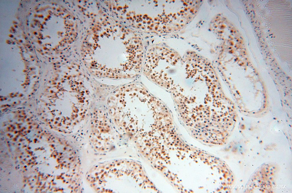 Immunohistochemistry (IHC) staining of human testis tissue using MAGEB18 Polyclonal antibody (17494-1-AP)