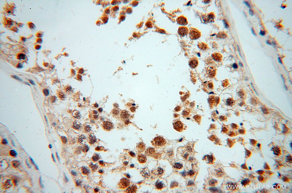 Immunohistochemistry (IHC) staining of human testis tissue using MAGEB18 Polyclonal antibody (17494-1-AP)