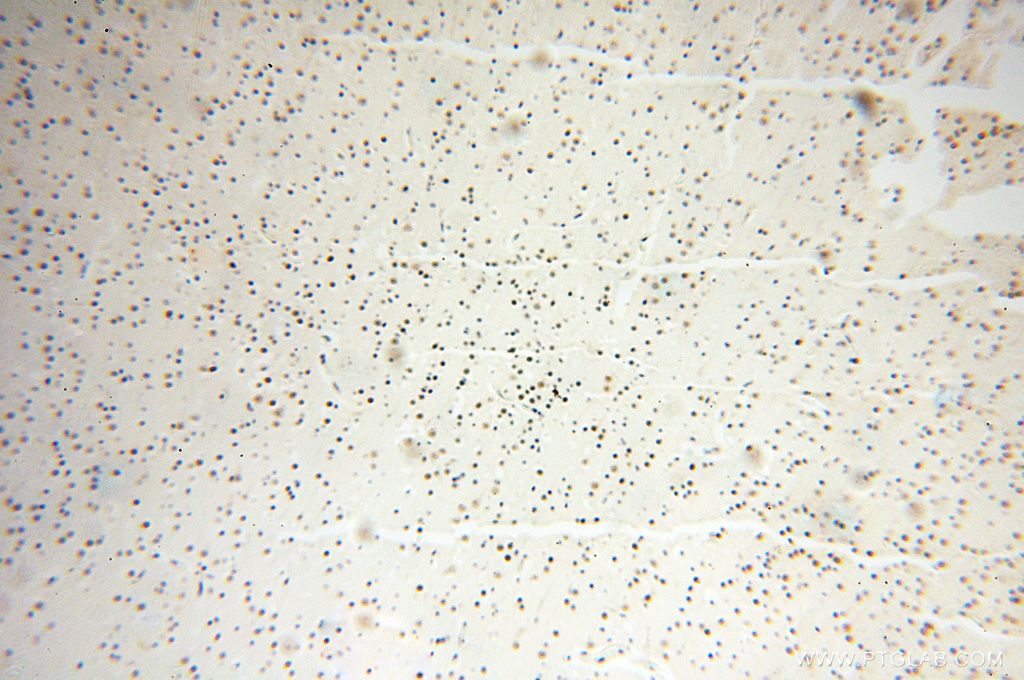 Immunohistochemistry (IHC) staining of human brain tissue using MAGEB18 Polyclonal antibody (17494-1-AP)