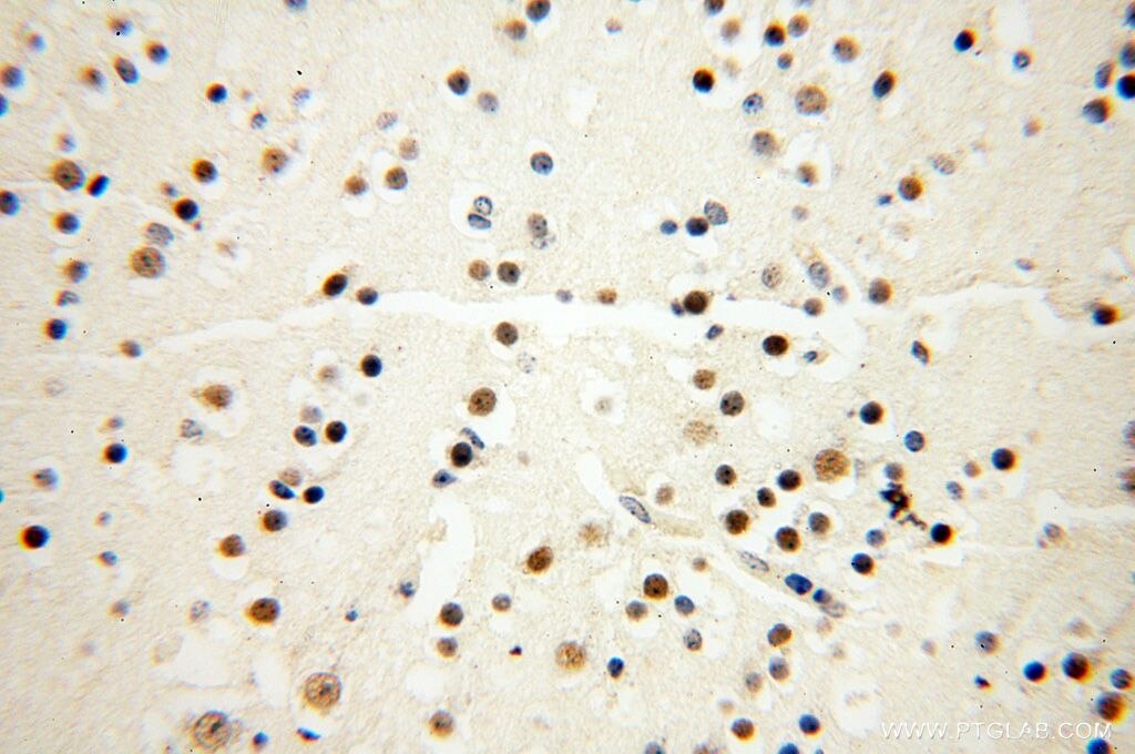 Immunohistochemistry (IHC) staining of human brain tissue using MAGEB18 Polyclonal antibody (17494-1-AP)