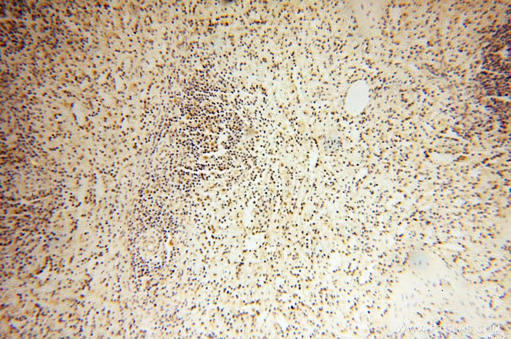 Immunohistochemistry (IHC) staining of human spleen tissue using MAGEB18 Polyclonal antibody (17494-1-AP)