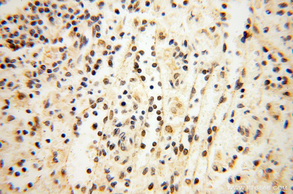 Immunohistochemistry (IHC) staining of human spleen tissue using MAGEB18 Polyclonal antibody (17494-1-AP)