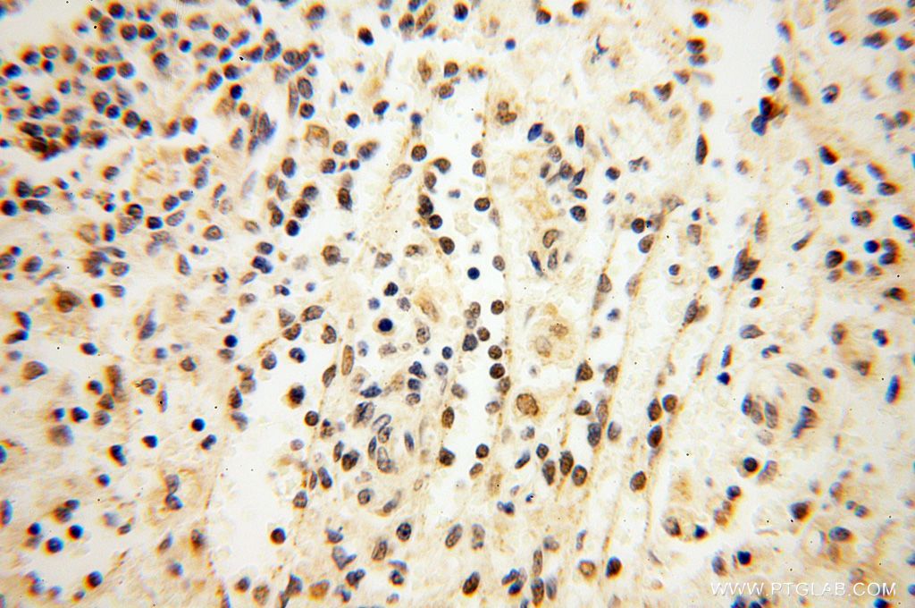Immunohistochemistry (IHC) staining of human spleen tissue using MAGEB18 Polyclonal antibody (17494-1-AP)