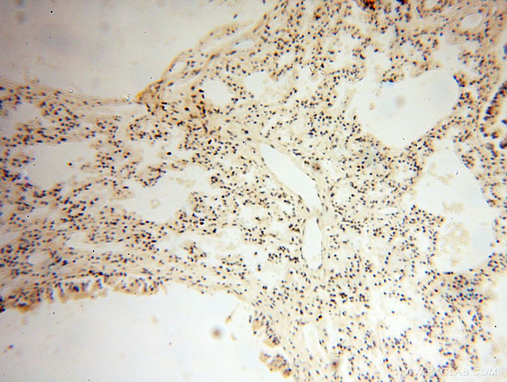 Immunohistochemistry (IHC) staining of human lung tissue using MAGEB18 Polyclonal antibody (17494-1-AP)