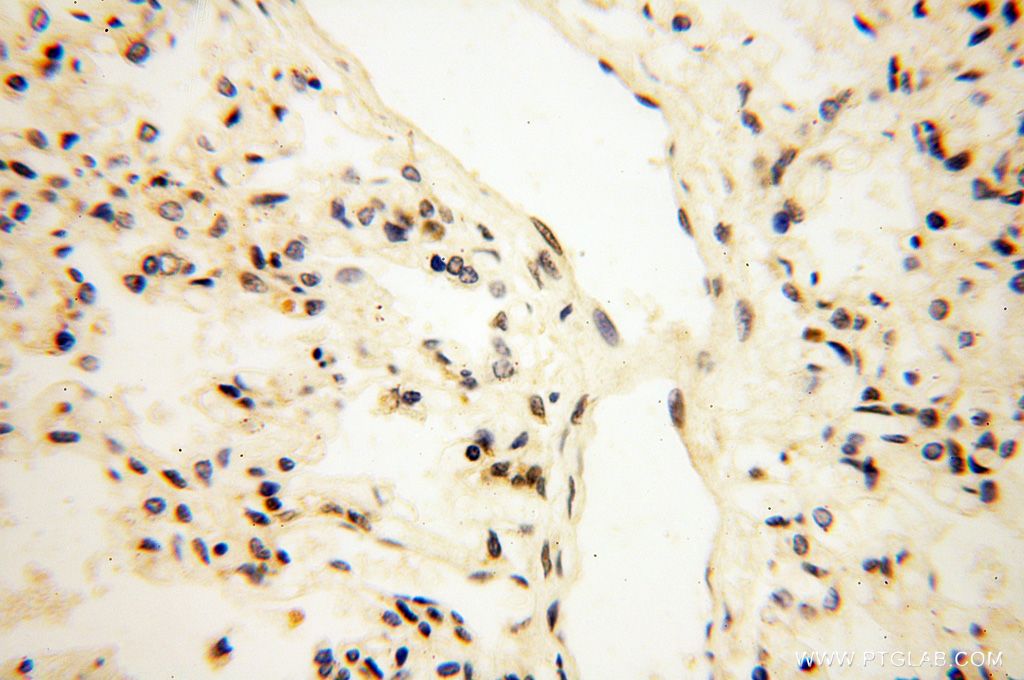 Immunohistochemistry (IHC) staining of human lung tissue using MAGEB18 Polyclonal antibody (17494-1-AP)