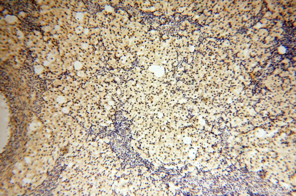 Immunohistochemistry (IHC) staining of human ovary tissue using MAGEB18 Polyclonal antibody (17494-1-AP)