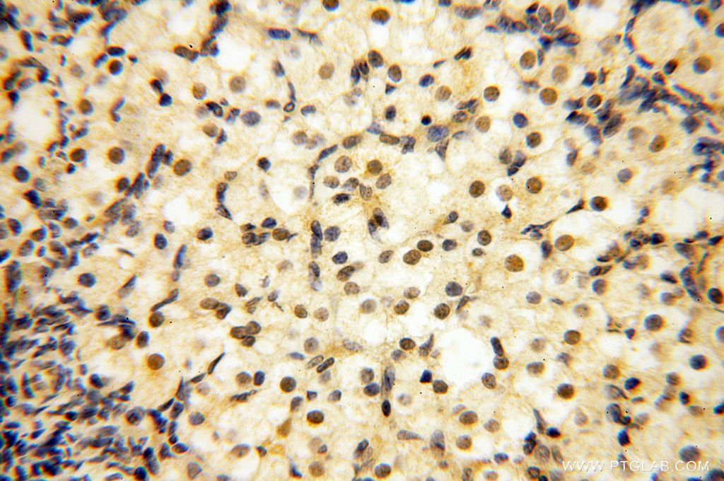 Immunohistochemistry (IHC) staining of human ovary tissue using MAGEB18 Polyclonal antibody (17494-1-AP)