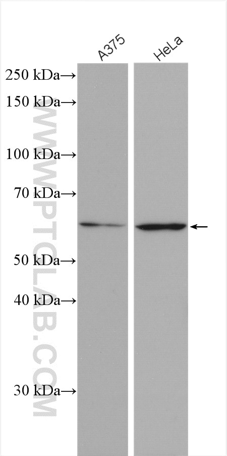 Western Blot (WB) analysis of various lysates using MAGEB18 Polyclonal antibody (17494-1-AP)