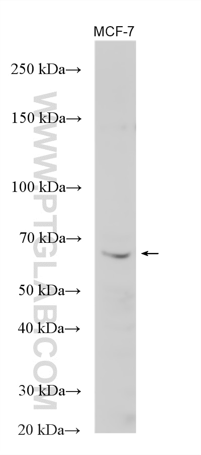 Western Blot (WB) analysis of various lysates using MAGEB18 Polyclonal antibody (17494-1-AP)