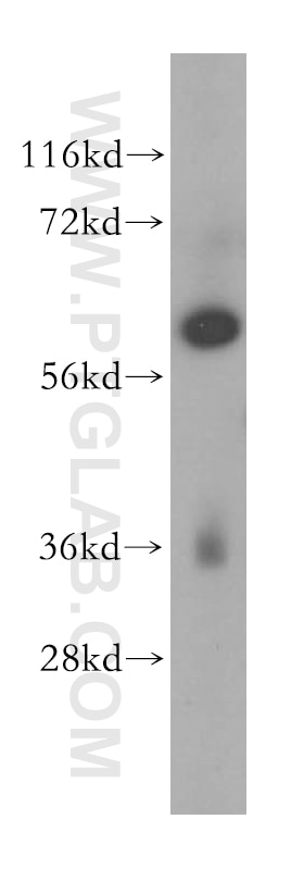 Western Blot (WB) analysis of HeLa cells using MAGEB18 Polyclonal antibody (17494-1-AP)