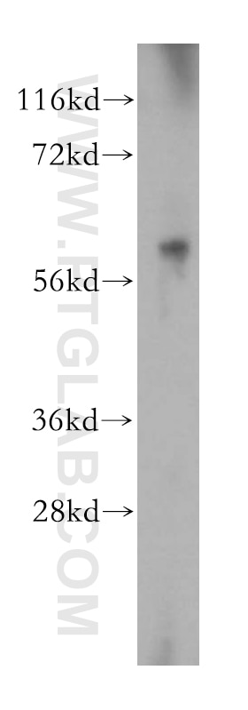 Western Blot (WB) analysis of A549 cells using MAGEB18 Polyclonal antibody (17494-1-AP)