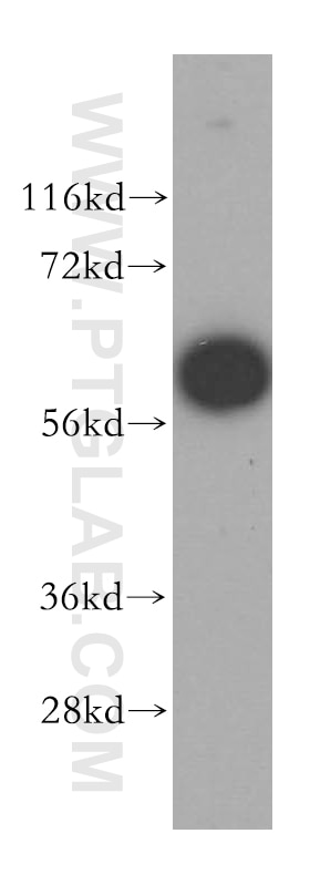 Western Blot (WB) analysis of MCF-7 cells using MAGEB18 Polyclonal antibody (17494-1-AP)