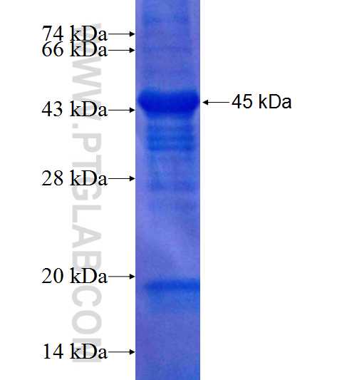 MAGEB18 fusion protein Ag11624 SDS-PAGE