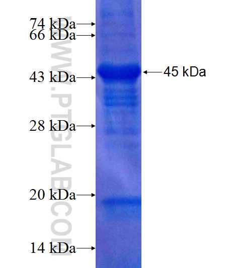 MAGEB18 fusion protein Ag11624 SDS-PAGE