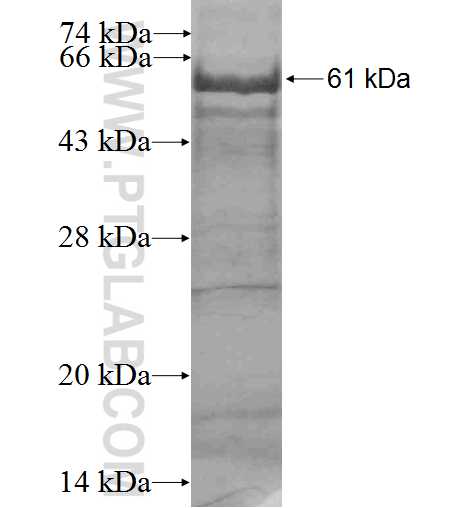 MAGEB2 fusion protein Ag3324 SDS-PAGE